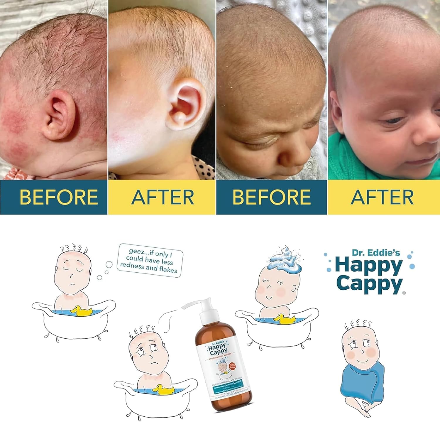 Happy Cappy Dr. Eddie’s Medicated Shampoo for Children, Treats Dandruff and Seborrheic Dermatitis, No Fragrance, Stops Flakes and Redness on Sensitive Scalps and Skin, 8 oz