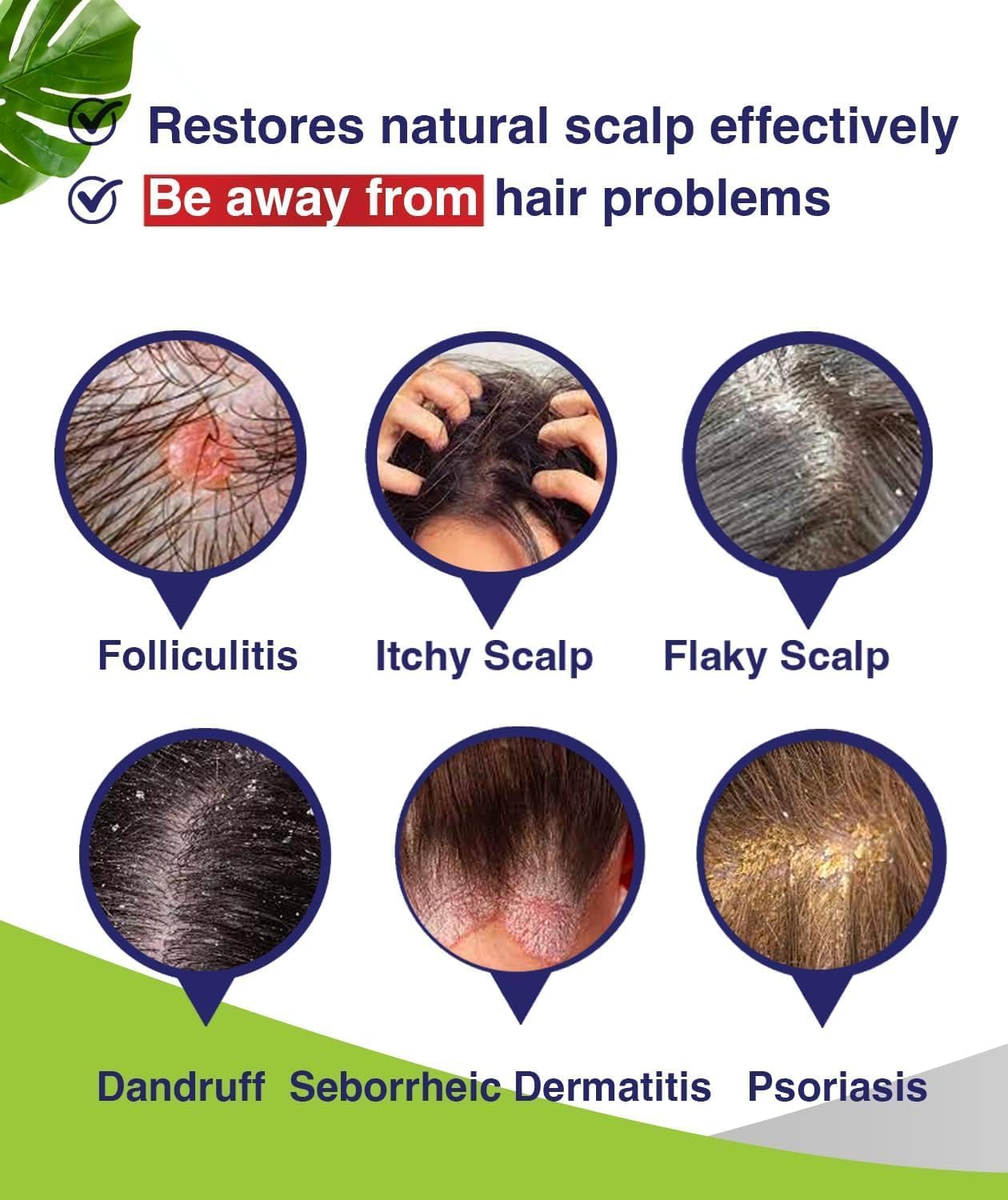 Folliculitis & Seborrheic Dermatitis Shampoo – Anti-Dandruff, Psoriasis & Itchy Scalp Treatment – Soothes Redness, Flaking & Irritation